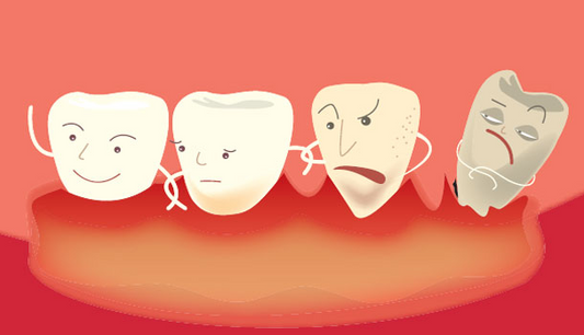 Taking NMN Can Prevent Periodontal Disease!